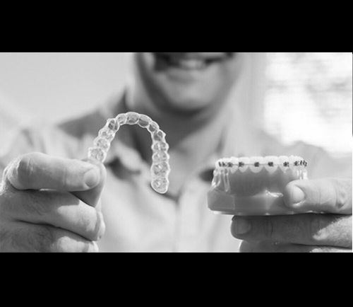 What Are Clear Aligners, Invisalign
