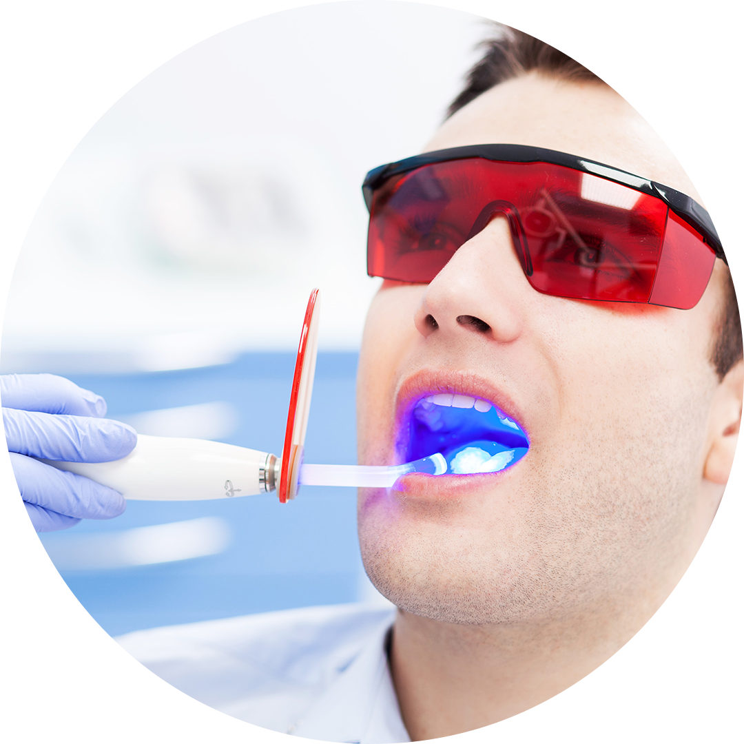 Laser Teeth Whitening Abu Dhabi Al Bahri Dental & Orthodontic Center