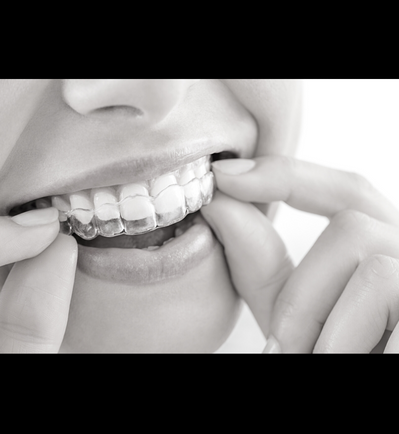 Is Invisalign Right for you?