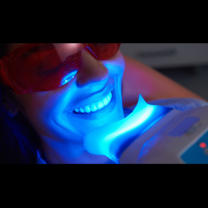 Laser Teeth Whitening in Abu Dhabi