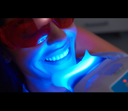 Laser Teeth Whitening in Abu Dhabi: Pros and Cons