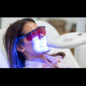 Laser Teeth Whitening in Abu Dhabi