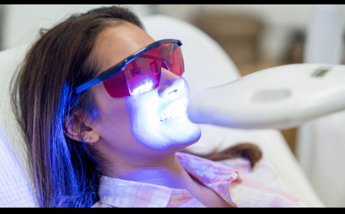 What You Should Know About Laser Teeth Whitening in Abu Dhabi?