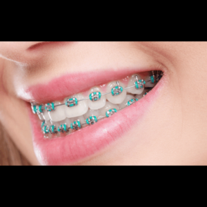 Best Orthodontist In Abu Dhabi