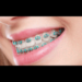 Straighten Your Teeth with Confidence: Visit the Best Orthodontist in Abu Dhabi – Al Bahri Dental