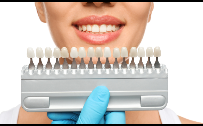 7 Benefits of Choosing a Professional Cosmetic Dentist