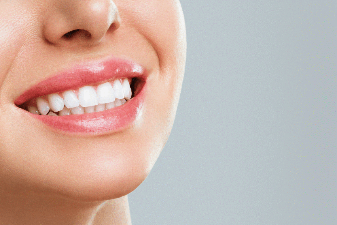 Best-Dental-Implants-in-Abu-Dhabi-2.png