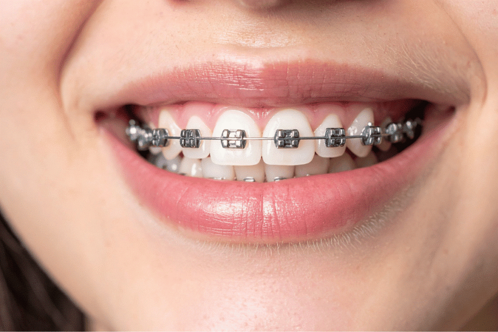 Child orthodontic assessment at Al Bahri Dental & Orthodontic Center