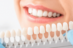 Dental Implants Abu Dhabi │ Al-Bahri Dental