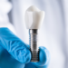 Can You Get a Dental Implant After Losing a Tooth Years Ago?
