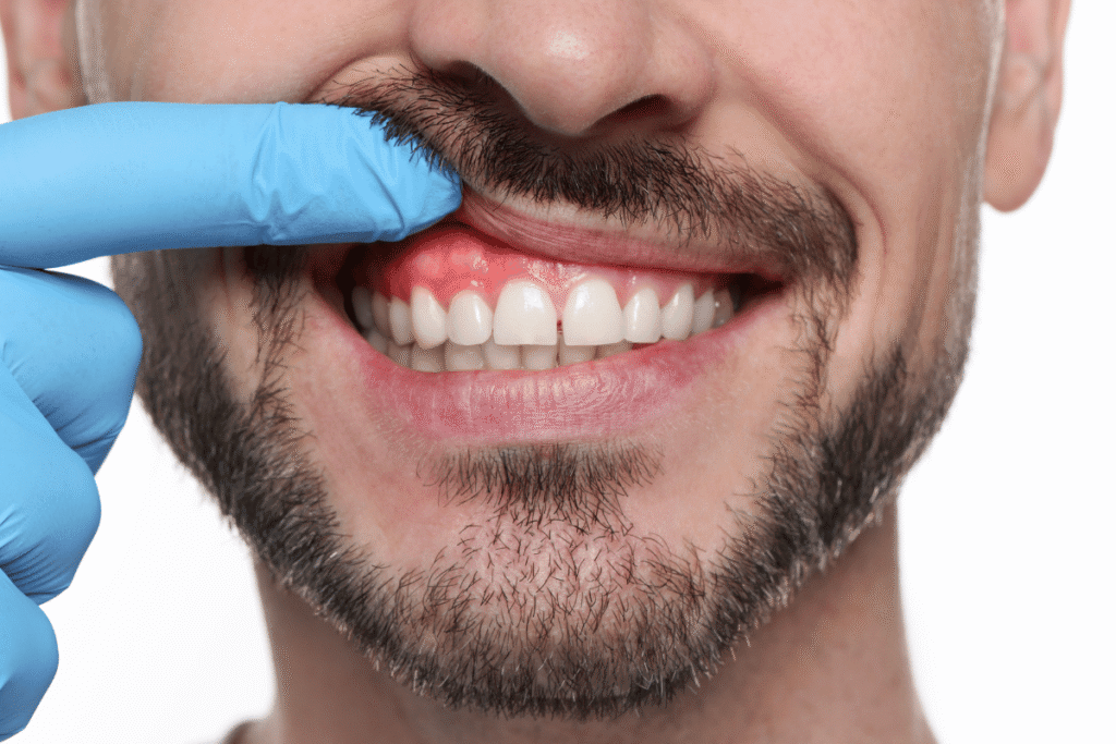 Dentist checking inflamed gums during dental check-up in Abu Dhabi