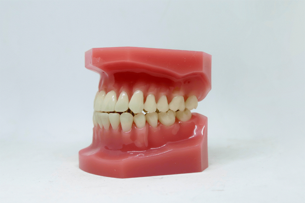 Dentist examining gum recession in a patient in Abu Dhabi clinic