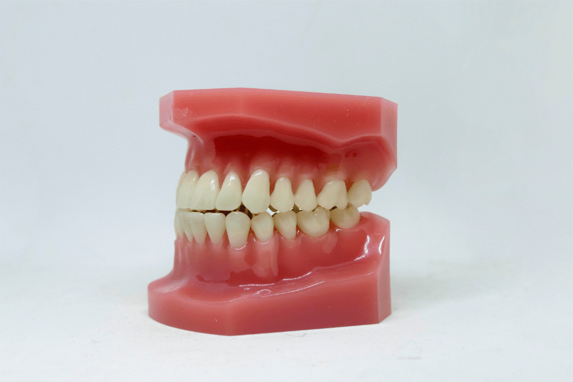 Dentist-examining-gum-recession-in-a-patient-in-Abu-Dhabi-clinic.png