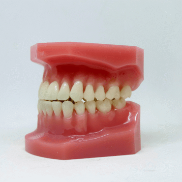 Why You Shouldn’t Ignore Gum Recession: Insights from the Best Dentists in Abu Dhabi