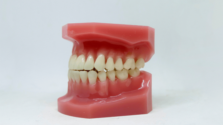 Why You Shouldn’t Ignore Gum Recession: Insights from the Best Dentists in Abu Dhabi