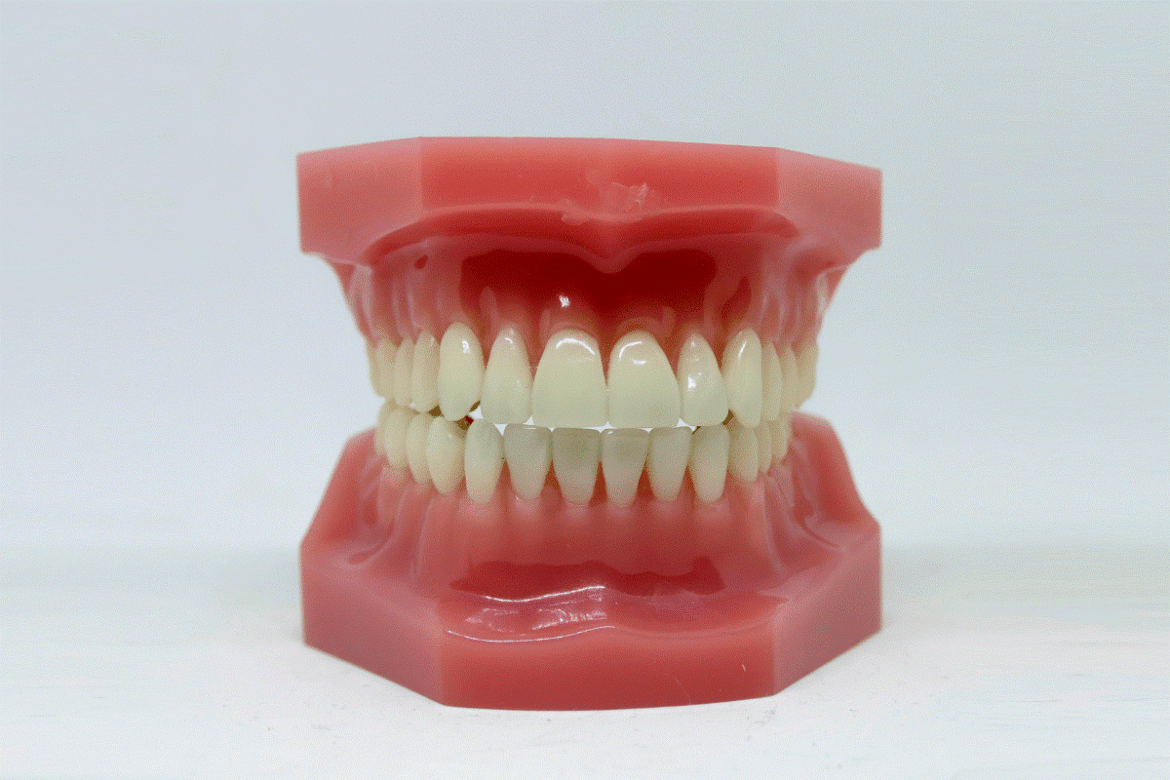 Dentist-removing-tartar-with-dental-scaling-tools.png
