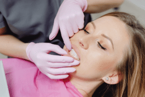 Early signs of gingivitis and bleeding gums close-up