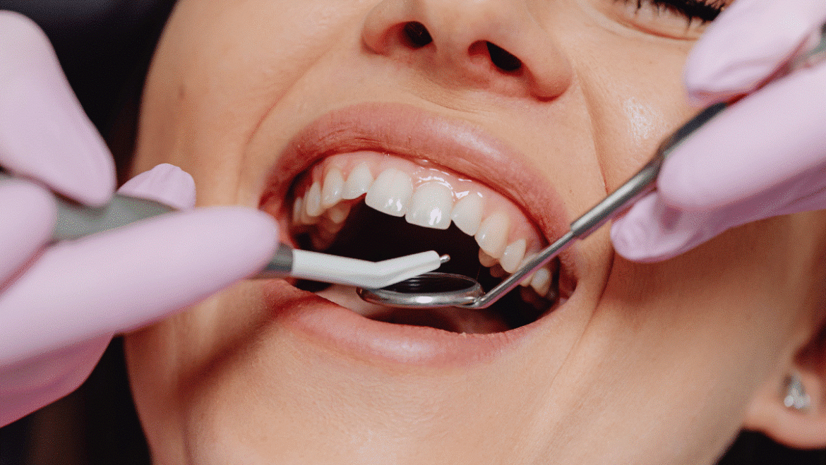 Why Natural-Looking Smiles Are the New Trend