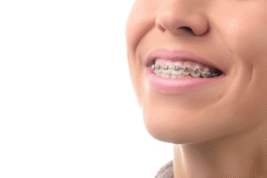Orthodontist in Abu Dhabi