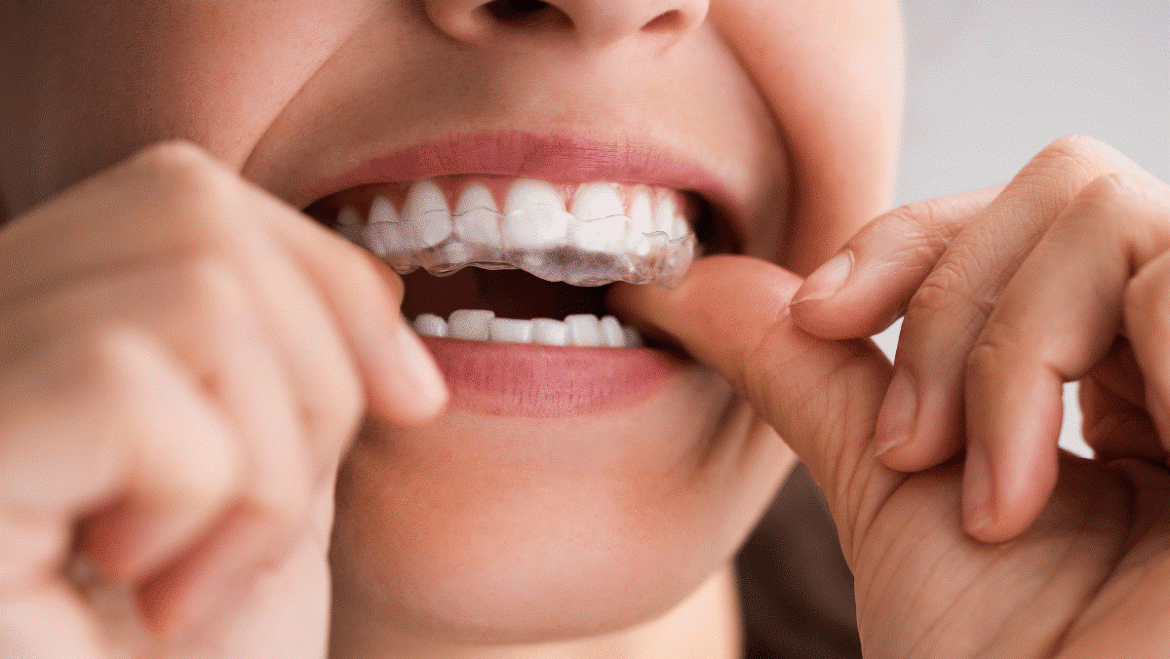 Top 5 Signs You Should Visit an Orthodontist in Abu Dhabi Now