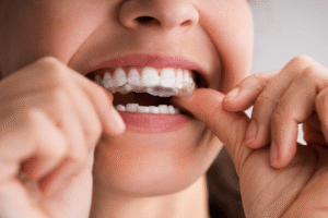 Orthodontist in Abu Dhabi treating crooked teeth with braces