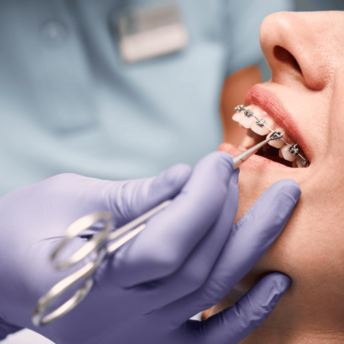 Orthodontist Al Ain | Essential Checklist for Selecting an Orthodontist for Braces |Al Bahri Dental and Orthodontic Center