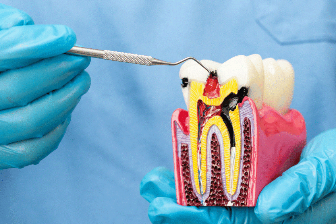 Patient-receiving-root-canal-restoration-and-dental-implant-consultation-in-Abu-Dhabi1.png