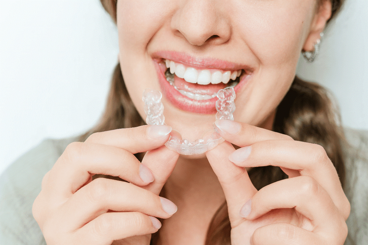 Patient-wearing-clear-dental-retainer-after-orthodontic-treatment-at-Al-Bahri-Dental-2.png