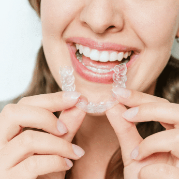 Why Are Retainers So Important?