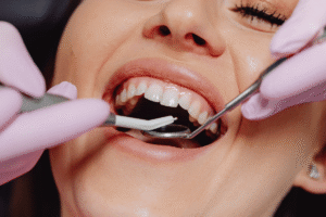 Professional dental cleaning for gum health